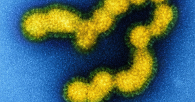最新研究揭示了猪源性流感病毒的抗病毒耐药性