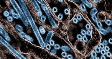 研究发现H5N1病毒的呼吸道传播潜力