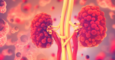 新研究：全球近8亿成年人患慢性肾脏病，  三十年间患者数翻番