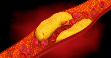 女性运动获益更大：同等心脏保护  所需运动量远低于男性